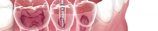 endodontiya