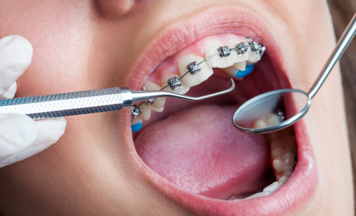 Какие проблемы может решить ортодонтическое лечение?