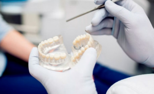 Как проходит процедура имплантации зубов?